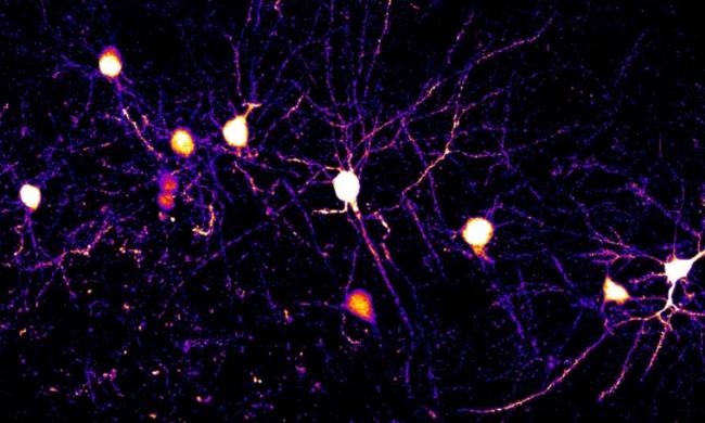 Neuronas y dendritas en la corteza cerebral de un ratón. / Komiyama Lab, UC San Diego