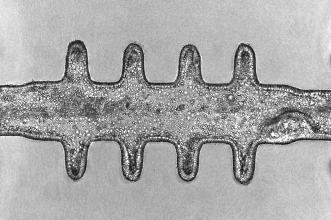 organoides de colon