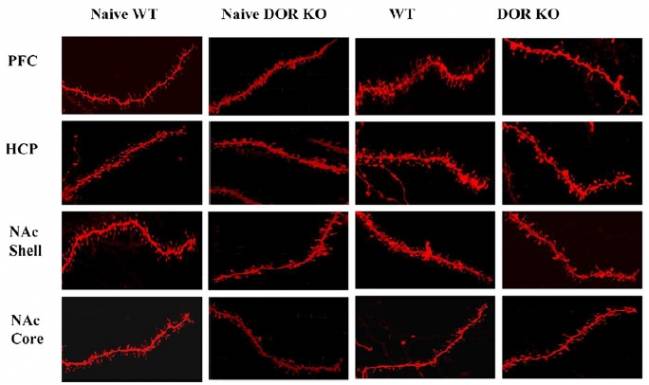 Figura: Cambios neuronales inducidos por el consumo de chocolate en ratones que no expresan el receptor DOR (DOR KO) y ratones normales (wild type). DCEXS-UPF